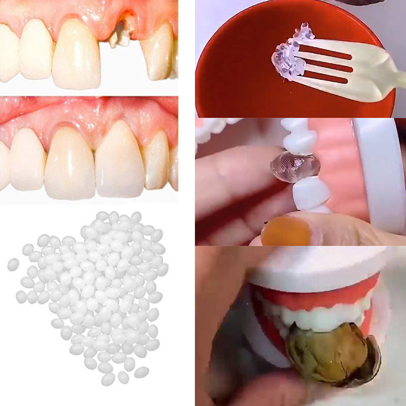 New Resin Dental Filling Material